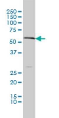 Western Blot: VMAT1/SLC18A1 Antibody (3A2-E10) [H00006570-M01]