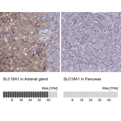 Immunohistochemistry-Paraffin: VMAT1/SLC18A1 Antibody [NBP2-58895]