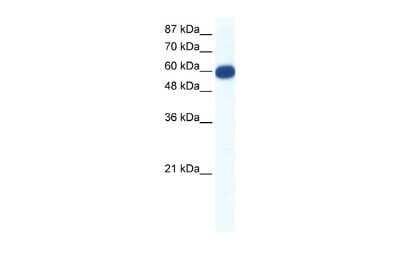 Western Blot: VMAT1/SLC18A1 Antibody [NBP2-88578]