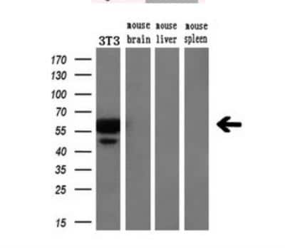 Western Blot: VMAT2 Antibody (OTI9E11) [NBP1-47977]
