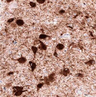 Immunohistochemistry-Paraffin: VMAT2 Antibody (CL12531) [NBP3-18570]