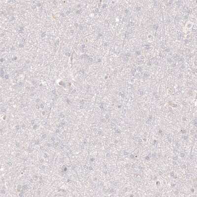 Immunohistochemistry-Paraffin: VMAT2 Antibody (CL12531) [NBP3-18570]