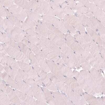 Immunohistochemistry-Paraffin: VMAT2 Antibody (CL13157) [NBP3-18556]