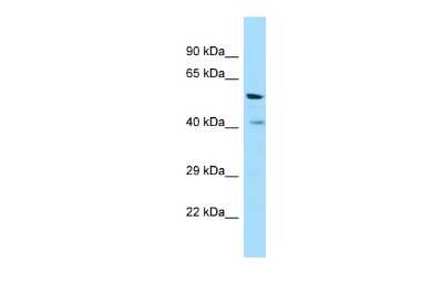 Western Blot: VN1R1 Antibody [NBP3-09465]