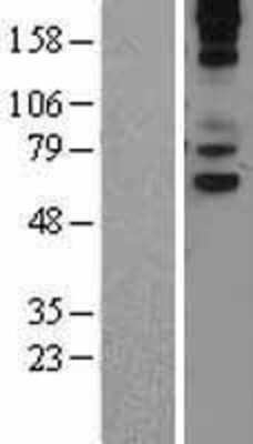 Western Blot: Vanin-1/VNN1 Overexpression Lysate [NBL1-17732]
