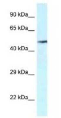 Western Blot: VNN2 Antibody [NBP1-79906]
