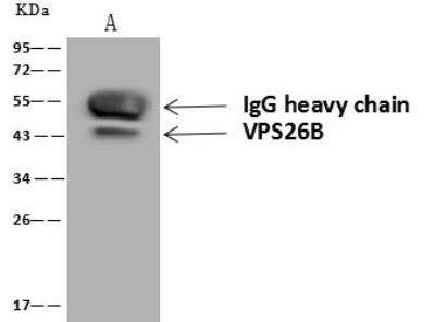 Immunoprecipitation: VP26B Antibody [NBP3-12624]