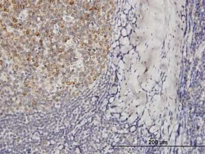 Immunohistochemistry-Paraffin: VPREB3 Antibody [H00029802-B01P]