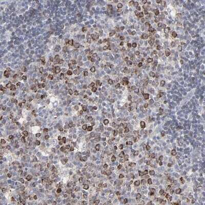 Immunohistochemistry-Paraffin: VPREB3 Antibody [NBP1-89347]