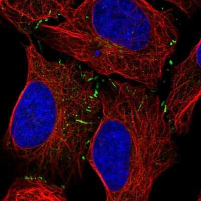 Immunocytochemistry/ Immunofluorescence: VPS13B Antibody [NBP2-55104]