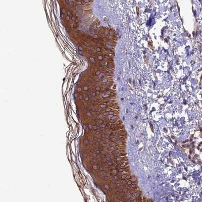 Immunohistochemistry: VPS16 Antibody [NBP2-48785]