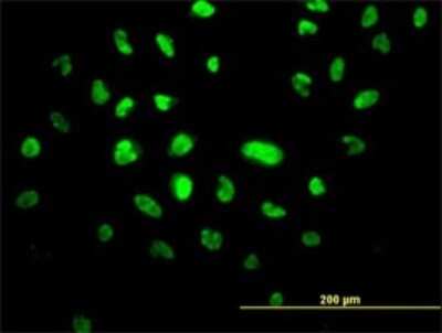 Immunocytochemistry/ Immunofluorescence: VPS25 Antibody (2E5-2B9) [H00084313-M01]