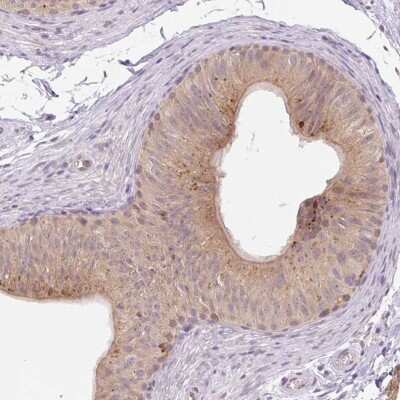 Immunohistochemistry-Paraffin: VPS25 Antibody [NBP2-33641]