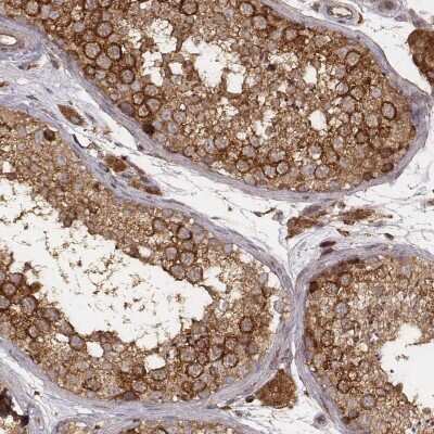 Immunohistochemistry-Paraffin: VPS26A Antibody (CL2287) [NBP2-36754]
