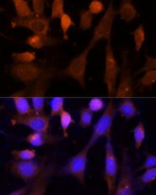 Immunocytochemistry/ Immunofluorescence: VPS26A Antibody - Azide and BSA Free [NBP2-93897]