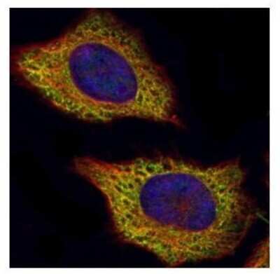 Immunocytochemistry/ Immunofluorescence: VPS28 Antibody [NBP2-20870]