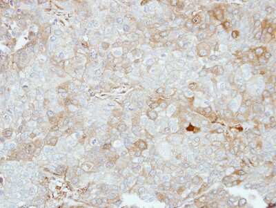 Immunohistochemistry-Paraffin: VPS28 Antibody [NBP2-20870]