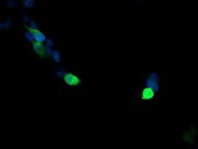 Immunocytochemistry/ Immunofluorescence: VPS28 Antibody (OTI1A8) - Azide and BSA Free [NBP2-74854]