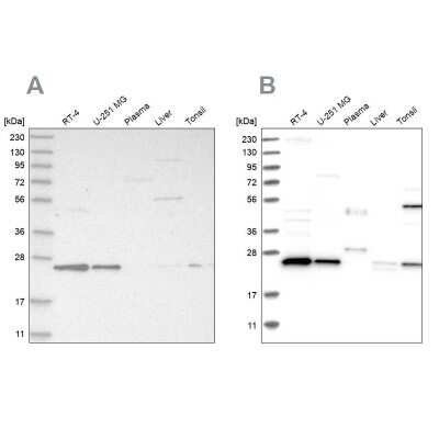Western Blot: VPS28 Antibody [NBP1-85973]