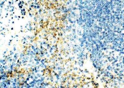 Immunohistochemistry-Paraffin: VPS29 Antibody [NBP3-12366]