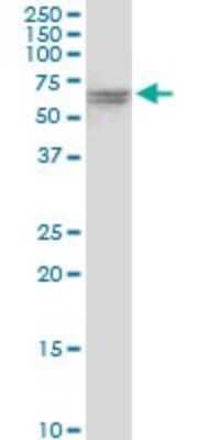 Western Blot: VPS33A Antibody [H00065082-B01P]