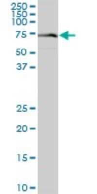 Western Blot: VPS33A Antibody [H00065082-B01P]