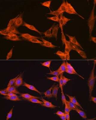 Immunocytochemistry/ Immunofluorescence: VPS34 Antibody (9U5O3) [NBP3-15441]