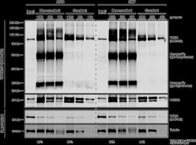 Immunoprecipitation: VPS35 Antibody (7E4) [NBP2-78823]