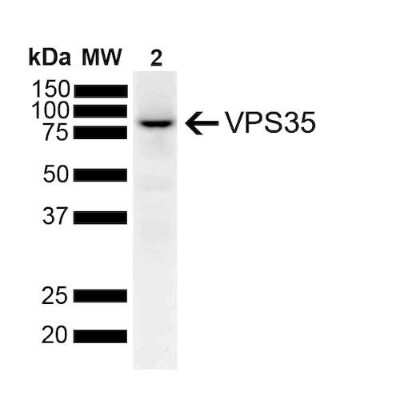 Western Blot: VPS35 Antibody (7E4) [NBP2-78823]