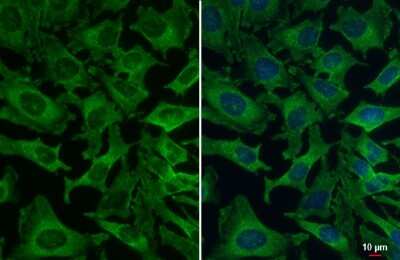 Immunocytochemistry/ Immunofluorescence: VPS35 Antibody (HL1017) [NBP3-13680]