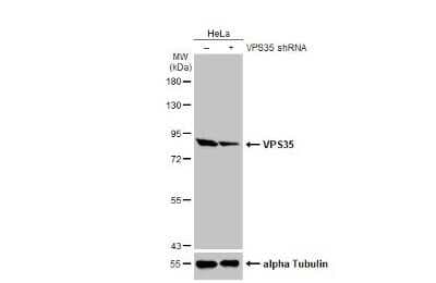 Western Blot: VPS35 Antibody (HL1017) [NBP3-13680]
