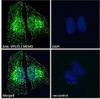 Immunocytochemistry/ Immunofluorescence: VPS35 Antibody [NB100-1397]