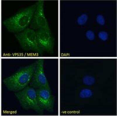 Immunocytochemistry/ Immunofluorescence: VPS35 Antibody [NB100-1397]