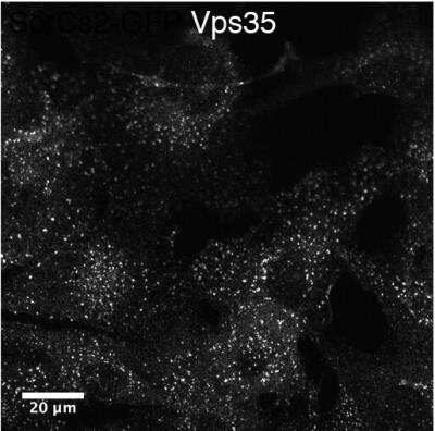 Immunocytochemistry/ Immunofluorescence: VPS35 Antibody [NB100-1397]