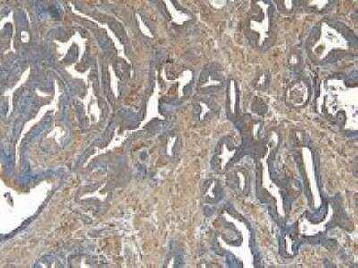 Immunohistochemistry-Paraffin: VPS35 Antibody [NB100-1397]