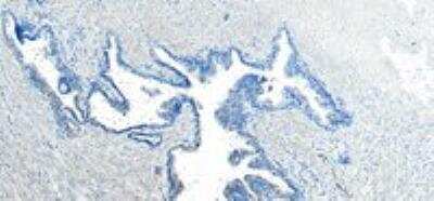 Immunohistochemistry-Paraffin: VPS35 Antibody [NB100-1397]