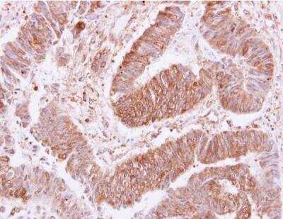 Immunohistochemistry-Paraffin: VPS35 Antibody [NBP1-31069]
