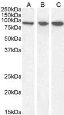 Western Blot: VPS35 Antibody [NB100-1397]