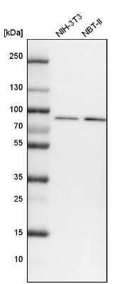Western Blot: VPS35 Antibody [NBP2-13517]