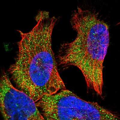 Immunocytochemistry/ Immunofluorescence: VPS37A Antibody [NBP1-81994]