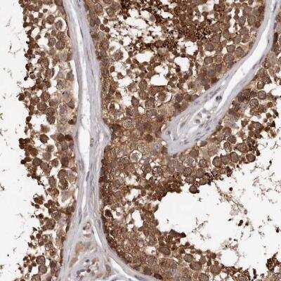 Immunohistochemistry: VPS37A Antibody [NBP1-81994]