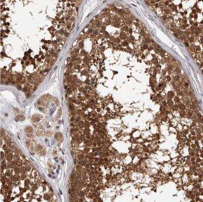 Immunohistochemistry-Paraffin: VPS37A Antibody [NBP1-83528]