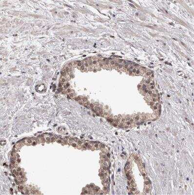 Immunohistochemistry-Paraffin: VPS37A Antibody [NBP1-83528]