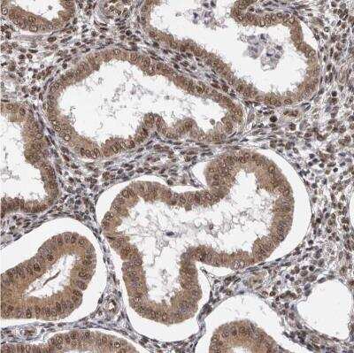Immunohistochemistry-Paraffin: VPS37A Antibody [NBP1-83528]