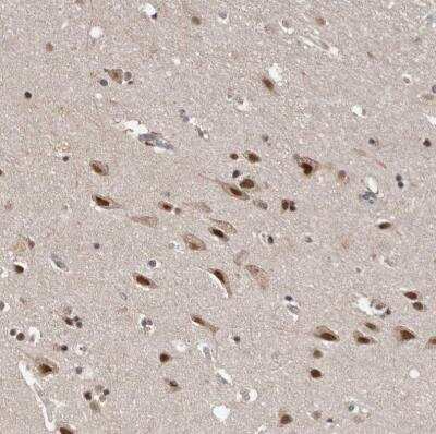 Immunohistochemistry-Paraffin: VPS37A Antibody [NBP1-83528]