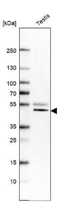 Western Blot: VPS37A Antibody [NBP1-83528]