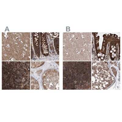 Immunohistochemistry-Paraffin: VPS37B Antibody [NBP2-38398]