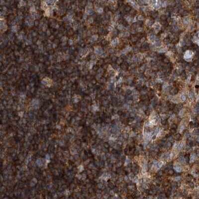 Immunohistochemistry-Paraffin: VPS37B Antibody [NBP2-38398]