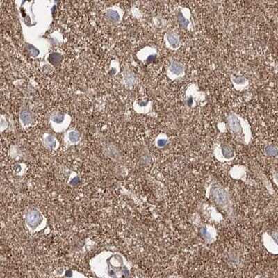 Immunohistochemistry-Paraffin: VPS37B Antibody [NBP2-38398]