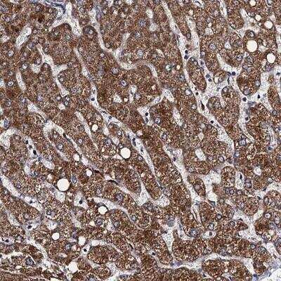 Immunohistochemistry: VPS37D Antibody [NBP1-93480]